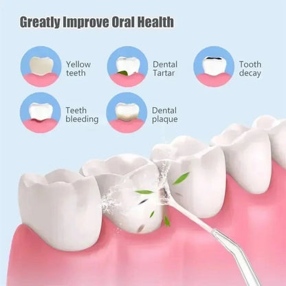 Aqua Clean - Irrigador Oral Impermeable Recargable Limpieza Dental Portátil con 3 Modos y Uso Doméstico